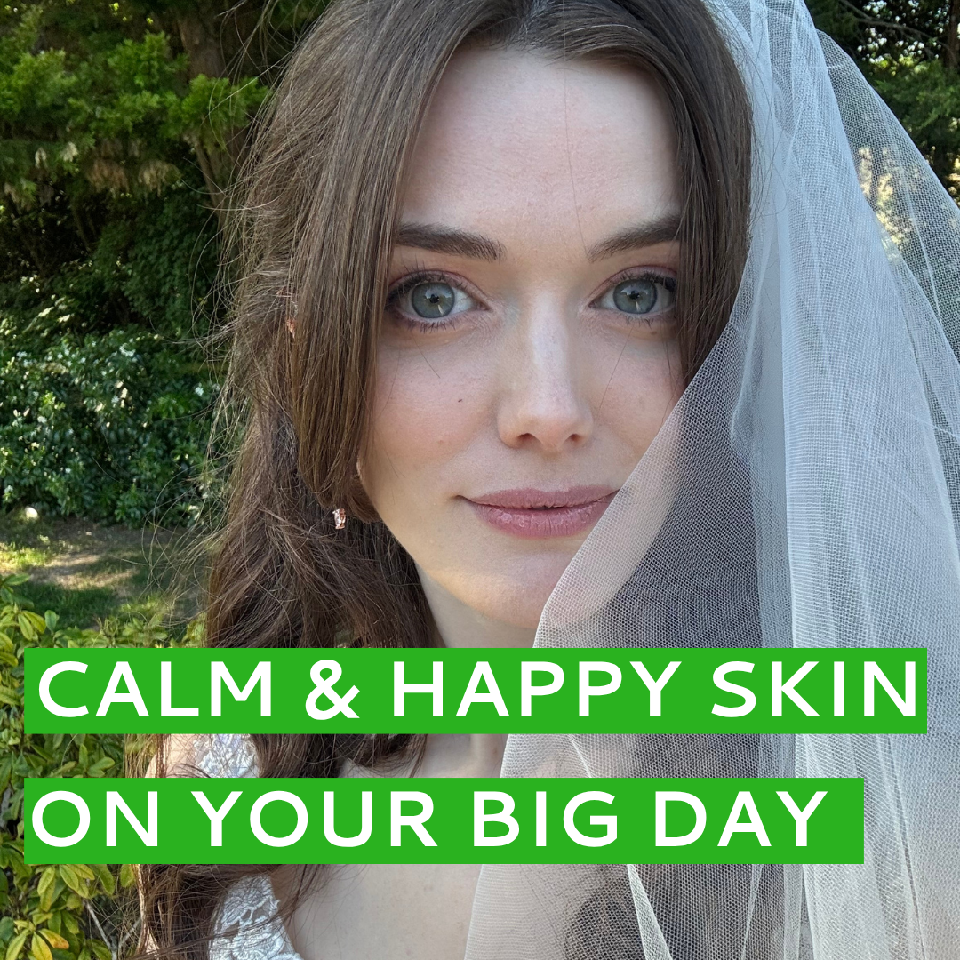 Sophie on Skin, Sensitivity and the Run-Up to the Big Day
