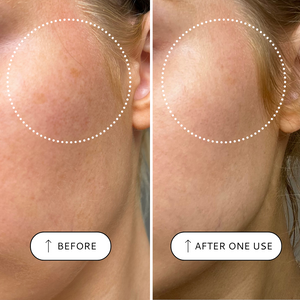 Sensitive Resurfacing Peel