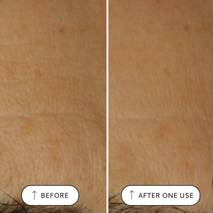 Super Renewal Serum 15ml